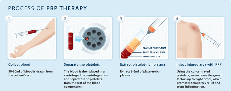 Platelet research.png