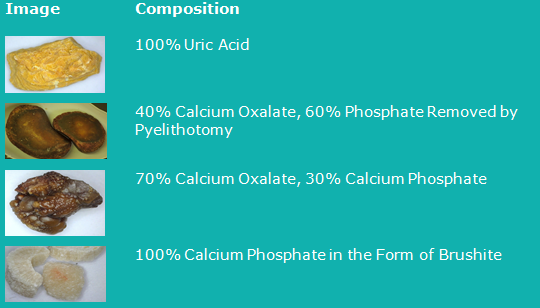 stones table 3_0.png